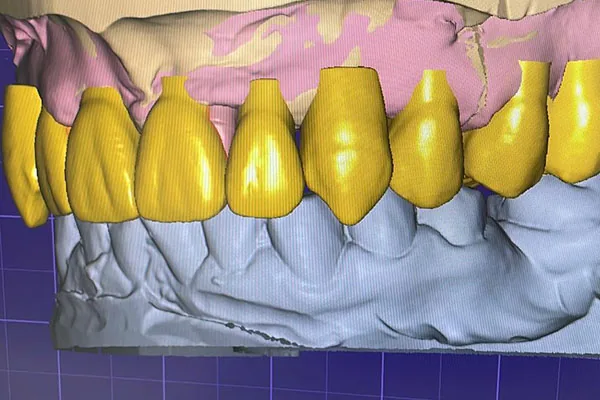 Cad-cam-teaser-4