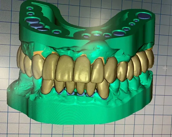 Top Zirkon – Cad cam
